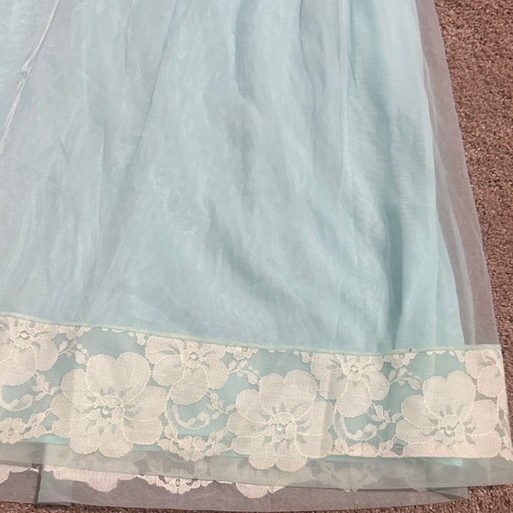 Elegant Blue Lace Lingerie - Picture 2 of 5